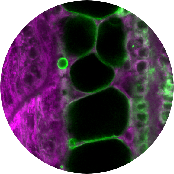 Differentiating cells in the notochord